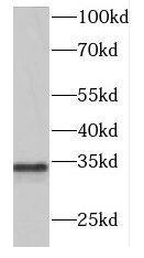 DNase II Antibody - BSA Free