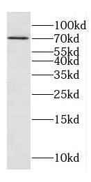 DNAJC21 Antibody - BSA Free