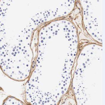 TMEM213 Antibody - BSA Free