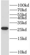 TMEM208 Antibody - BSA Free