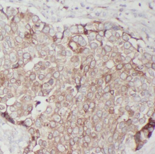 TMEM199 Antibody - BSA Free