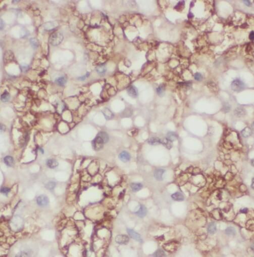 TMEM182 Antibody - BSA Free