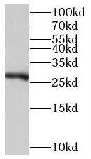 TMEM176A Antibody - BSA Free