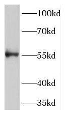 MGC4618 Antibody - BSA Free