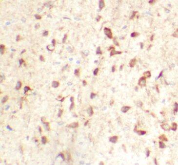 MGC4618 Antibody - BSA Free