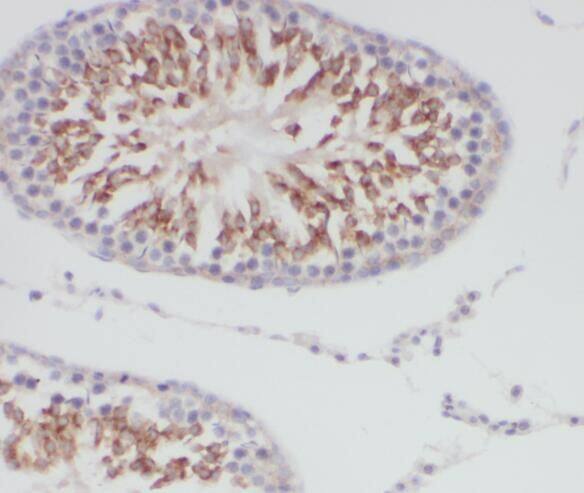 TMEM168 Antibody - BSA Free
