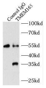 TMEM165 Antibody - BSA Free
