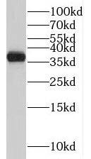 TMEM165 Antibody - BSA Free