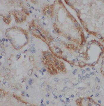 TMEM154 Antibody - BSA Free