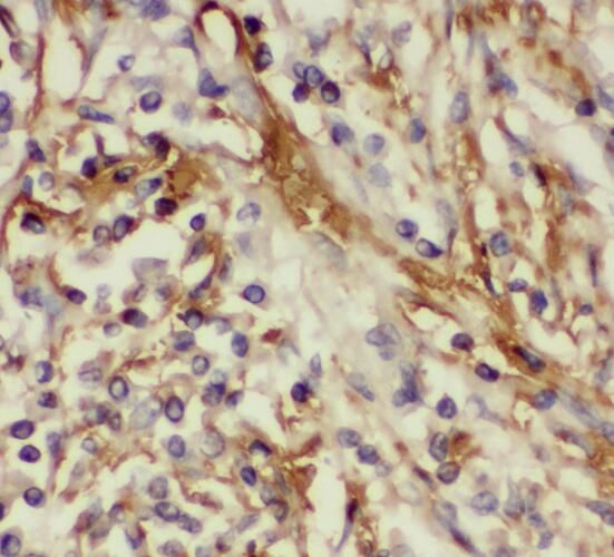 TMEM139 Antibody - BSA Free