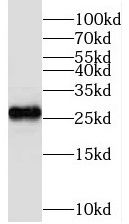 TMEM139 Antibody - BSA Free
