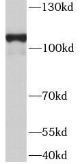 TMEM132A Antibody - BSA Free
