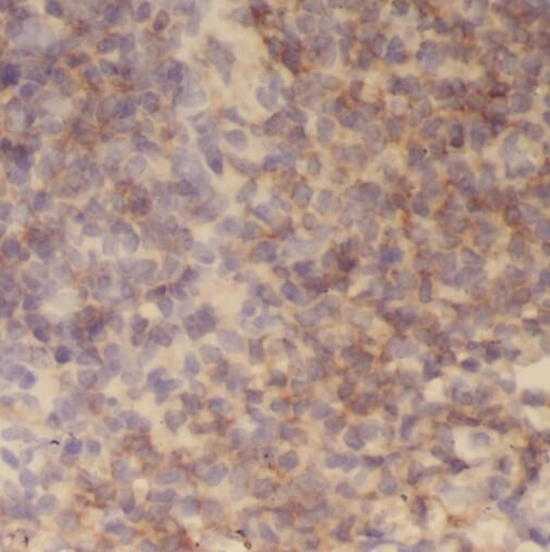 TMCO6 Antibody - BSA Free