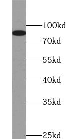 TMC1 Antibody - BSA Free