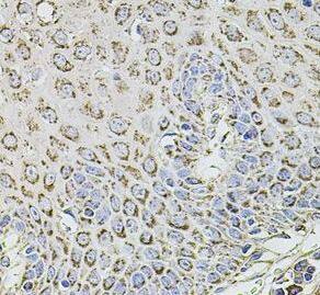 TMC1 Antibody - BSA Free