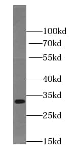 TIMMDC1 Antibody - BSA Free
