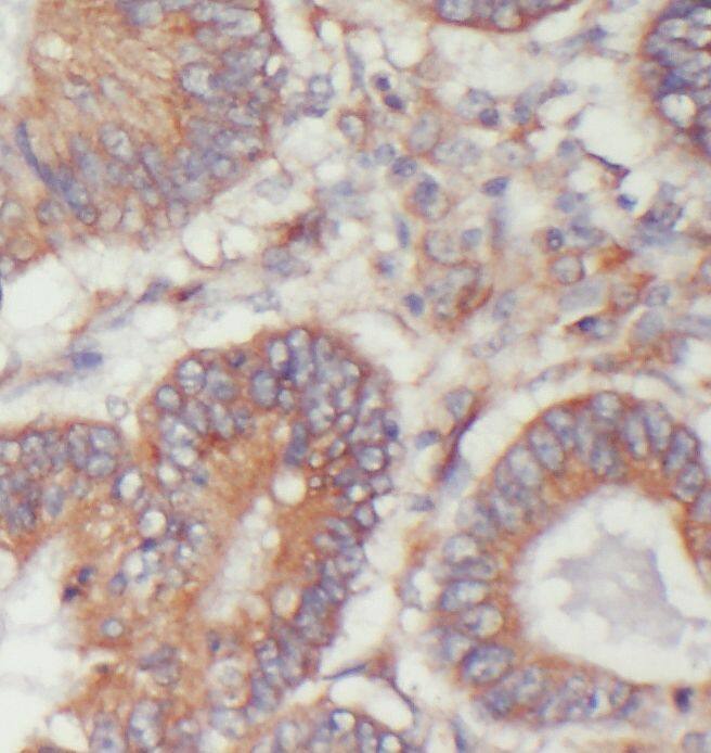 TIMM17B Antibody - BSA Free