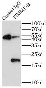 TIMM17B Antibody - BSA Free