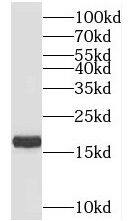 TIMM17B Antibody - BSA Free
