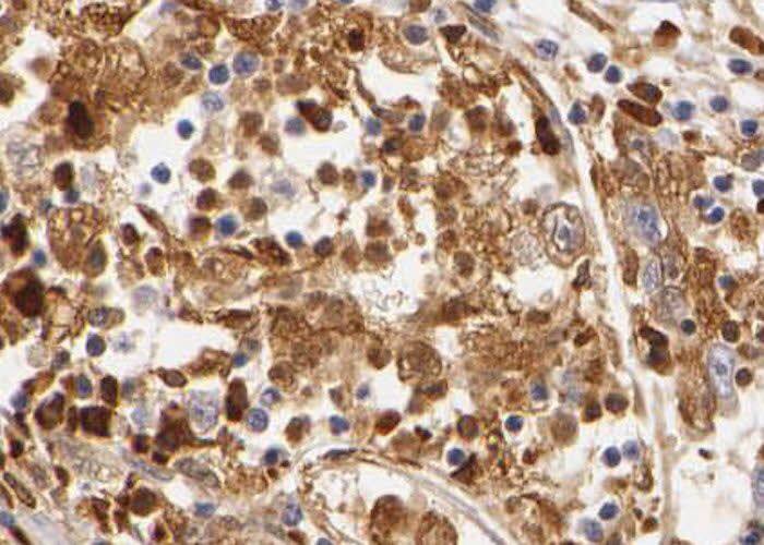 THUMPD3 Antibody - BSA Free