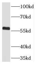 THUMPD3 Antibody - BSA Free