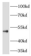 THUMPD1 Antibody - BSA Free