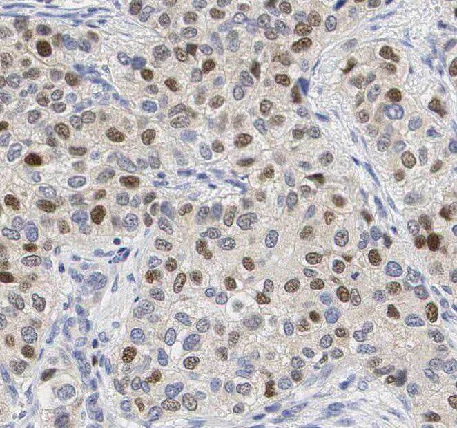 THUMPD1 Antibody - BSA Free
