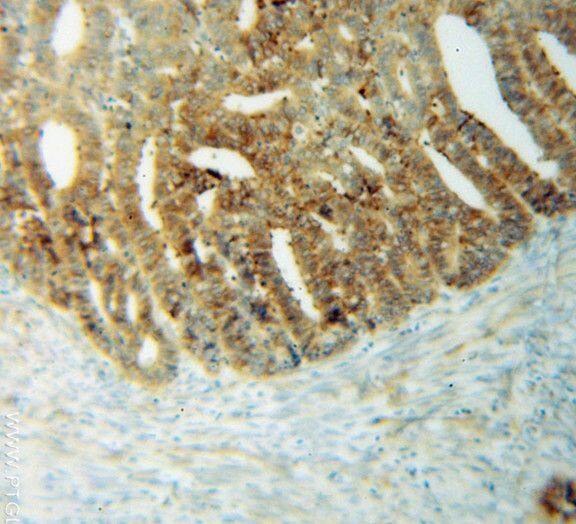 THEM4 Antibody - BSA Free