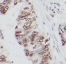 THAP1 Antibody - BSA Free
