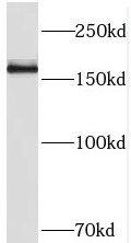 THADA Antibody - BSA Free