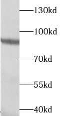 Transglutaminase 5 Antibody - BSA Free