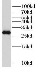 TFPT Antibody - BSA Free