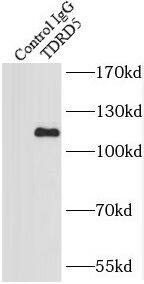 TDRD5 Antibody - BSA Free