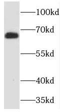 TCTN3 Antibody - BSA Free