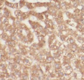 TCTN2 Antibody - BSA Free