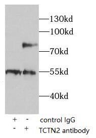 TCTN2 Antibody - BSA Free
