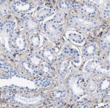 TCTN1 Antibody - BSA Free