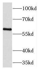 TCTN1 Antibody - BSA Free