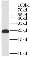 TCP10L Antibody - BSA Free