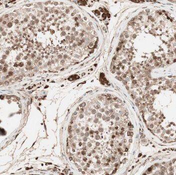 TCP10L Antibody - BSA Free