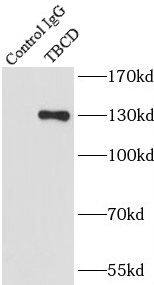 TBCD Antibody - BSA Free