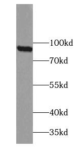 TBC1D5 Antibody - BSA Free