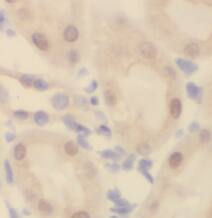 TBC1D5 Antibody - BSA Free