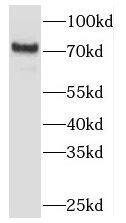 TBC1D23 Antibody - BSA Free