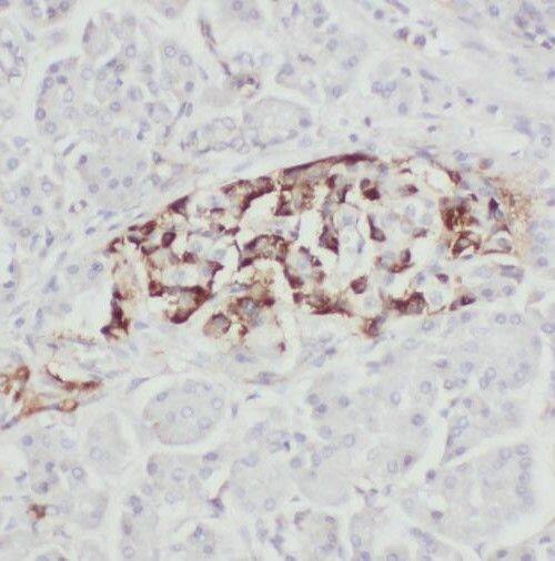 TBC1D19 Antibody - BSA Free