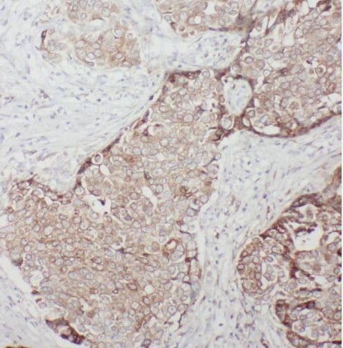 TBC1D17 Antibody - BSA Free