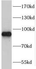TARSL2 Antibody - BSA Free