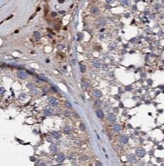 TADA1L Antibody - BSA Free