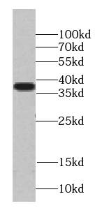 TADA1L Antibody - BSA Free