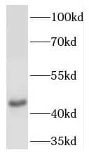 NK2R Antibody - BSA Free